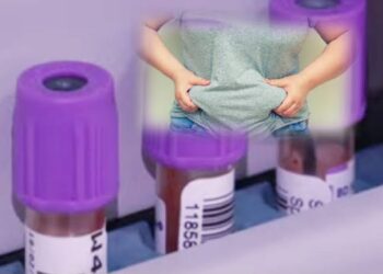 دراسة فنلندية : دهون البطن ترفع خطر السلس البولي الإجهادي لدى النساء في منتصف العمر